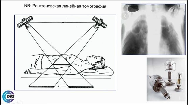 Ознакомительная вводная лекция по основам рентгенологии.  Часть 3.