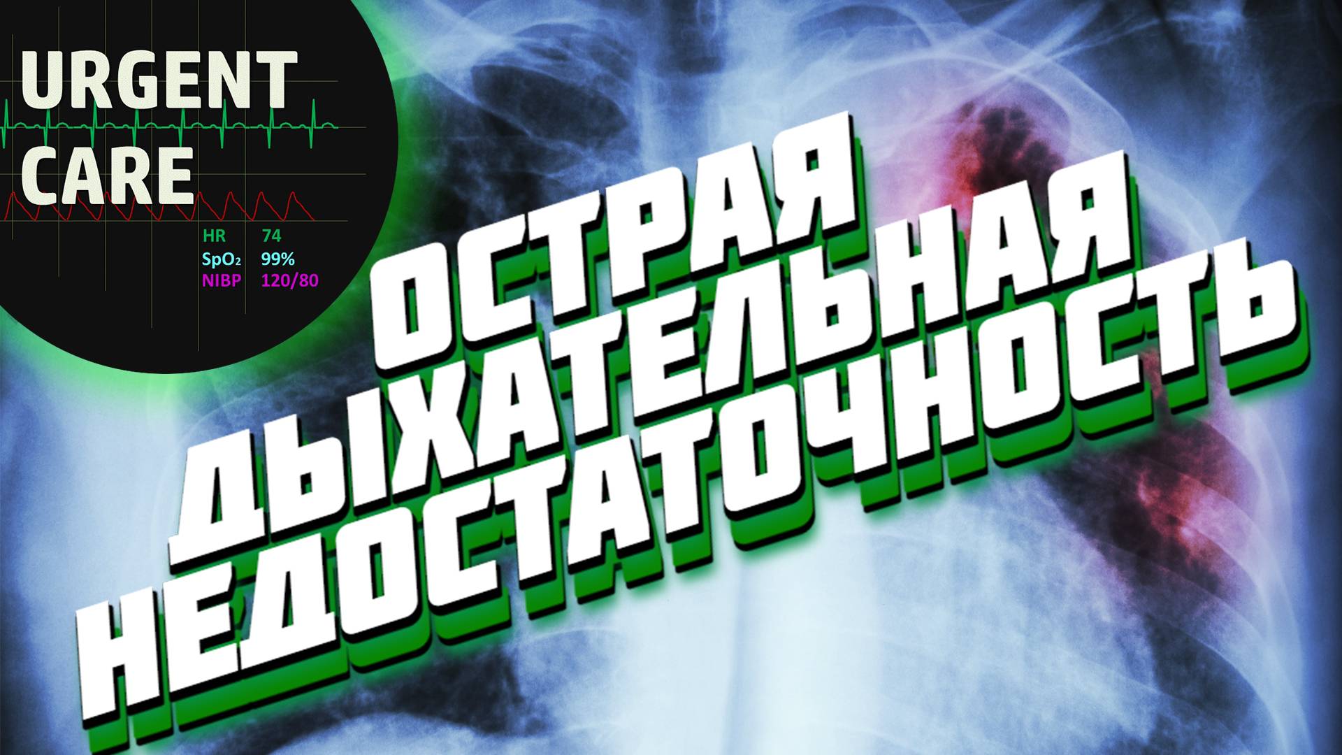 Острая дыхательная недостаточность. Лекция смотреть онлайн
