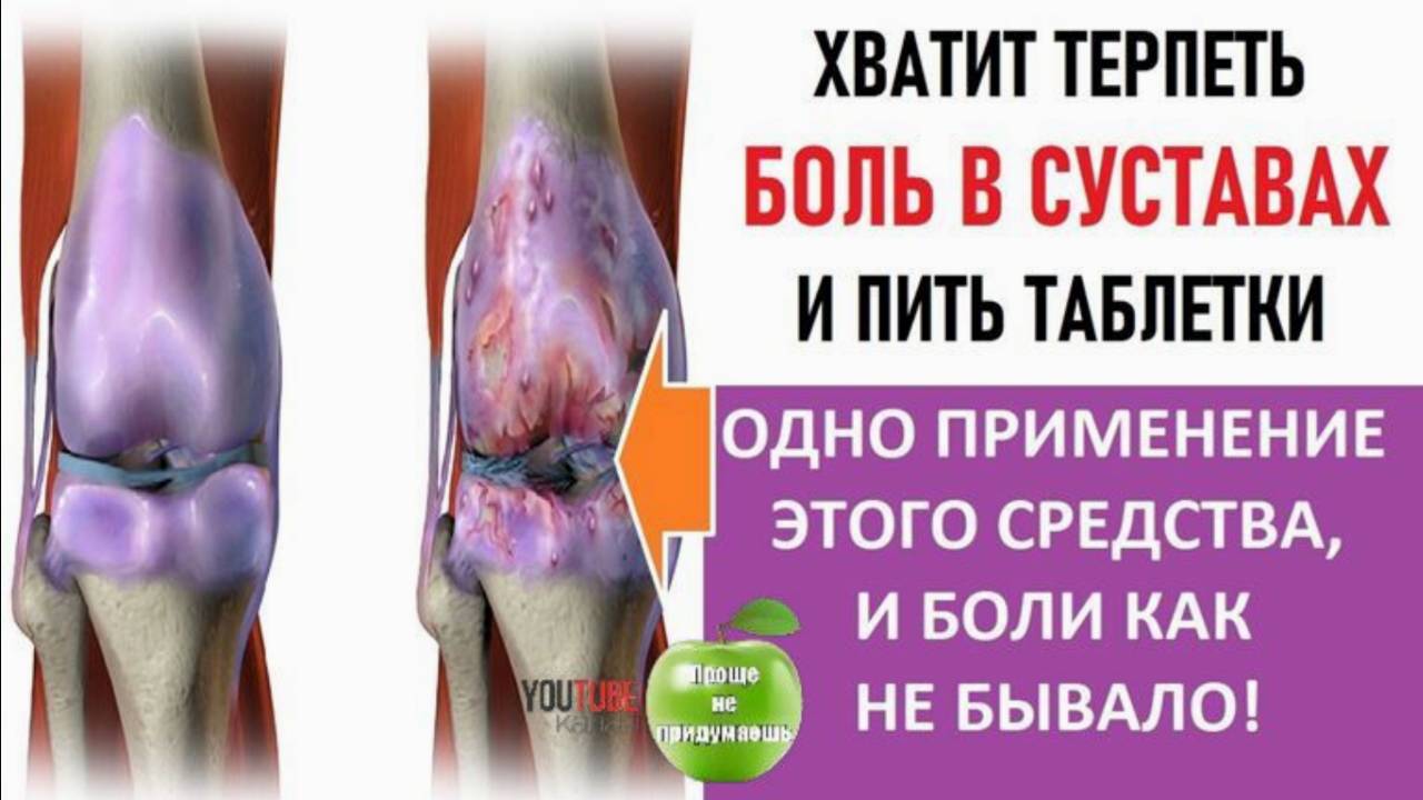 Облегчить боль в СУСТАВАХ поможет старинный рецепт русской народной медицины. Готовим мазь дома.