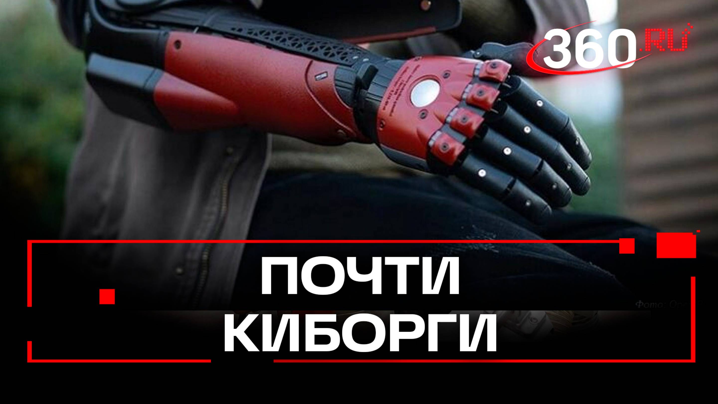 Бионические протезы можно получить бесплатно в Москве