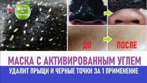Маска для лица с активированным углём, удалит прыщи и черные точки