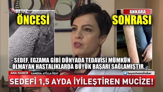 Sedefi bir buçuk ayda iyileştiren mucize! смотреть онлайн