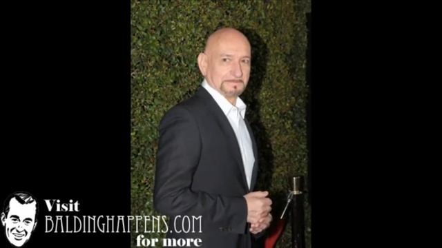 Ben Kingsley Hair Loss