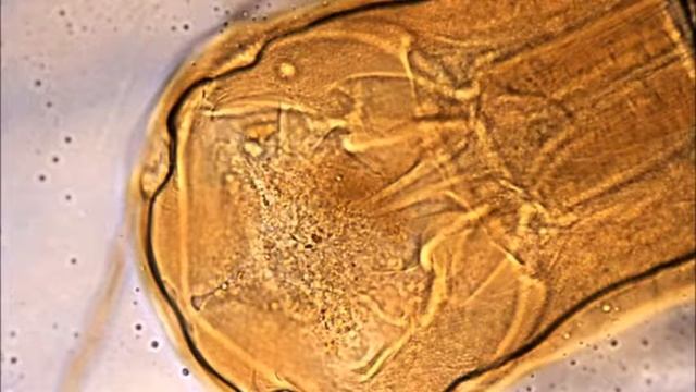 Hookworms 101 смотреть онлайн