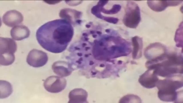 Ciencia y Salud Leishmaniasis HIGH смотреть онлайн