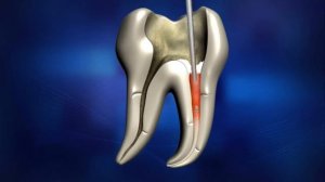 DiaDent ● Dia-Gun & Dia-Pen (Training)