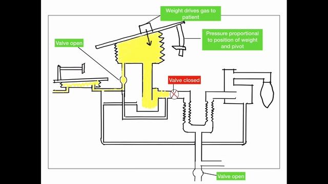 Manley Blease ventilator explained. Important source of anaesthetic exam MCQ questions смотреть онлайн
