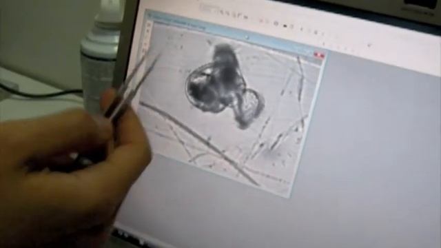 Studying the swimming performance of Bostrycapulus calyptraeformis larvae смотреть онлайн