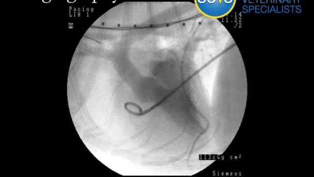 balloon valvuloplasty смотреть онлайн