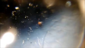 Infestação pelo Carrapato Rhipicephalus sanguineus - Cães, Gatos e humanos