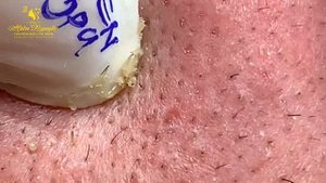 Satisfying Hien Spa Beauty Relaxing Video #26