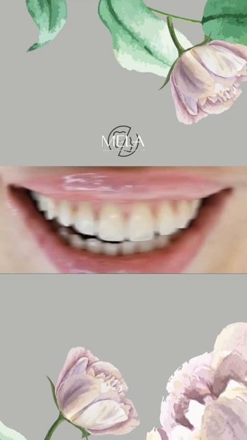 Как убрать диастему? Наш врач Зарина провела композитную реставрацию зубов всего за одно посещение смотреть онлайн