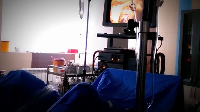 Операция на увеличена простата с Тулиум лазер 200 вата в Лейзър Мед