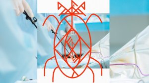 Точечное удаление новообразований