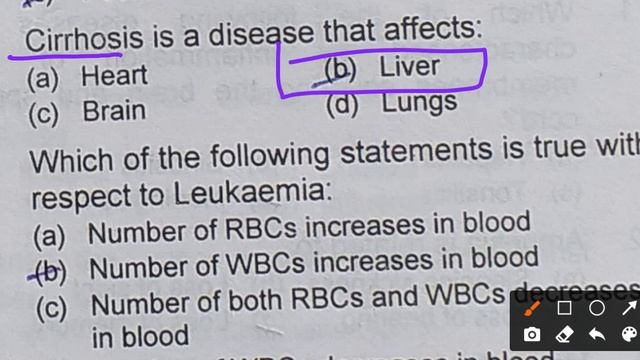 PPSC Mcqs On Diseases