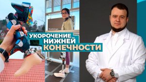 Что делать с укорочением ноги