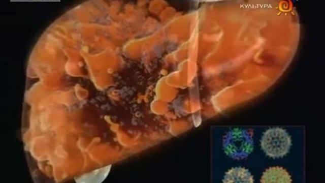 болезни печени.flv смотреть онлайн