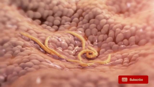 Worst Parasites!  Mangoworms Ticks Tunga Penetrans Tapeworms!