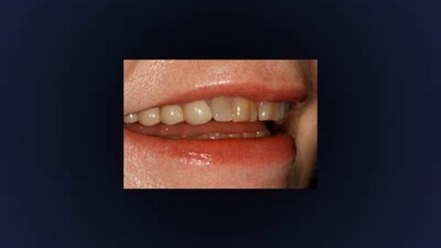 Smile Makeovers by George Kirtley D.D.S смотреть онлайн