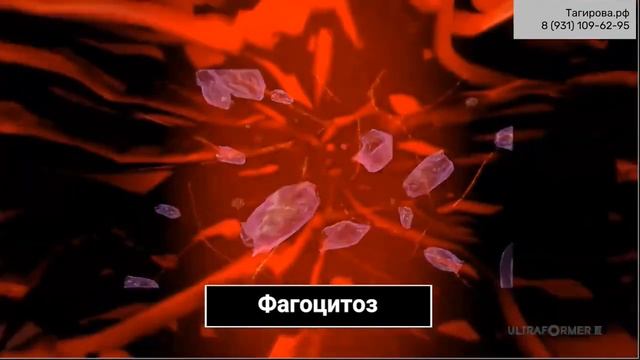 Ultraformer3 смотреть онлайн