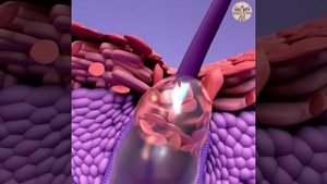 🚑Как избавиться от прыщей всего за 1 ночь?🚑👉В ОПИСАНИЕ👈