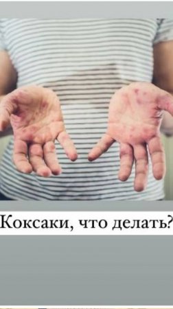 Коксаки, что делать?