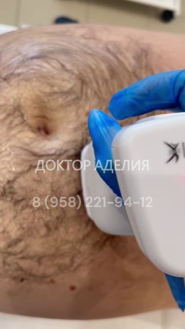 Липосоникс от Аделии смотреть онлайн