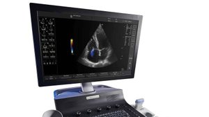 УЗИ аппарат Versana Balance GE MEDICO TRADE