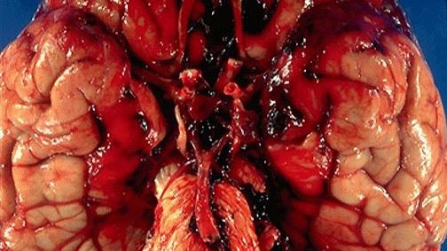 Простые нарушения кровообращения