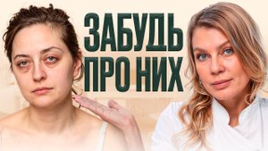 Как убрать отеки и мешки под глазами БЕЗ дорогостоящих процедур и пластики?