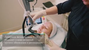Лазерная фракционная CO2-шлифовка лица