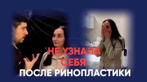 Риносептопластика: от операционной до первого результата