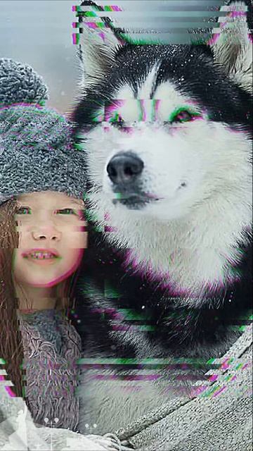 Собаки породы хаски откусили лицо мальчику в Адлере. Сочи. Краснодарский край.