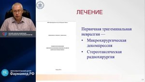 Тригеминальная невралгия Карелов А.Е