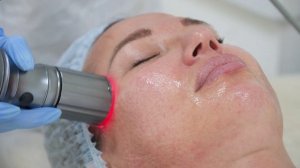 Лазерная биоревитализация в Институте на Трубной