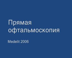 Прямая офтальмоскопия