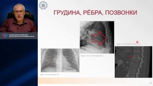 Боль в грудной клетке Карелов А.Е