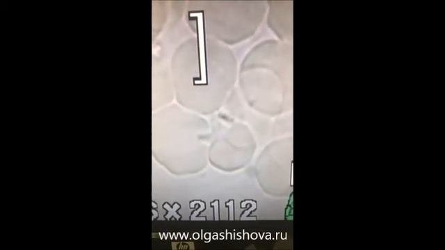 Причины диареи?