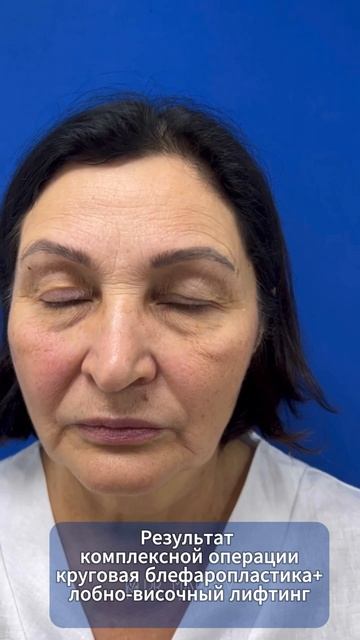 Результаты комплексной операции омоложения смотреть онлайн