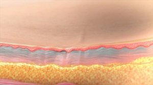 Inmode Morpheus 8 - Клиника профессора Юцковской