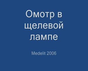 Осмотр в щелевой лампе
