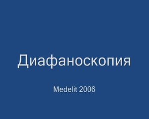 Диафаноскопия