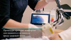 Фракционная СО2-шлифовка растяжек, стрий