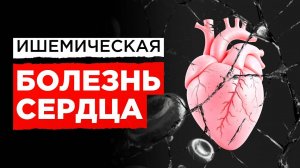 Заболевания Сердца: Почему ИБС Часто Приводит к Инфаркту?