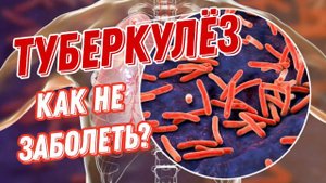 Туберкулез. Диагностика, профилактика и лечение.