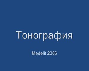 Тонография