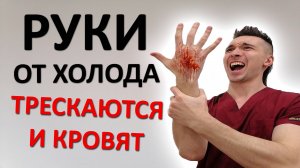 Руки СОХНУТ и ТРЕСКАЮТСЯ на холоде. Самый ЛУЧШИЙ способ по избавлению от КСЕРОЗА