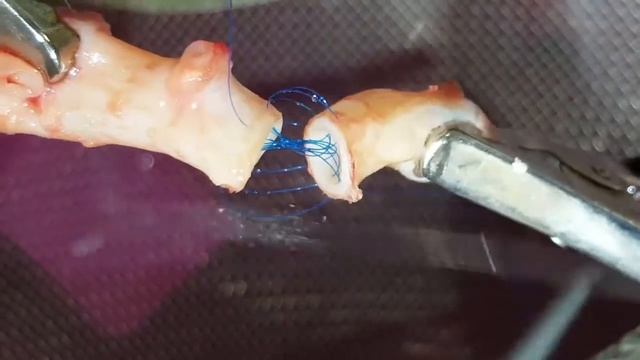 Сосудистый анастомоз конец в конец