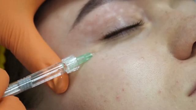 meso eye смотреть онлайн