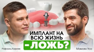 МИФЫ О ЗУБНЫХ ИМПЛАНТАХ: Это больно? Как избежать отторжения и что нужно знать пациенту? Усо Мамоян